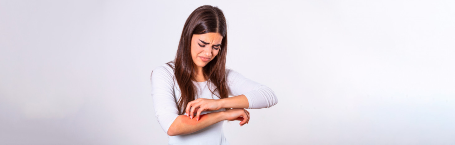 Tudo o que precisa saber sobre a Dermatite Atópica